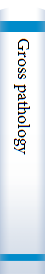 Gross pathology